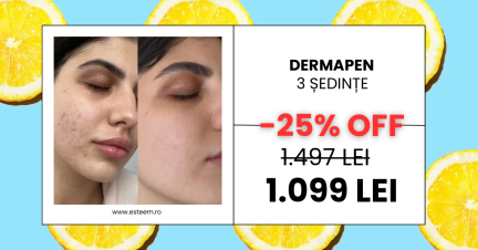 -50% reducere dacă vii cu o prietenă - 10