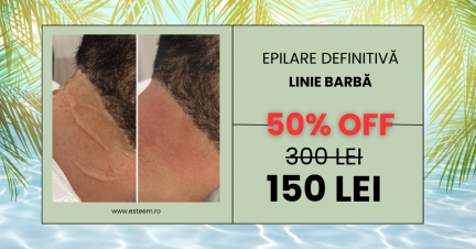 -50% reducere dacă vii cu o prietenă - 4