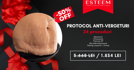 oferta 5 - antivergeturi